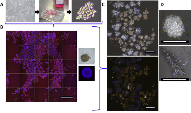 IBC 3D tumor spheroid high content assay.