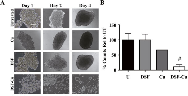 DSF-Cu disrupts formation of IBC tumor emboli under in vitro simulated growth conditions.