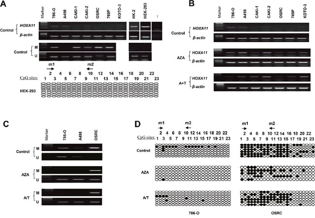 Methylation and expression status of HOXA11 in RCC cell lines.