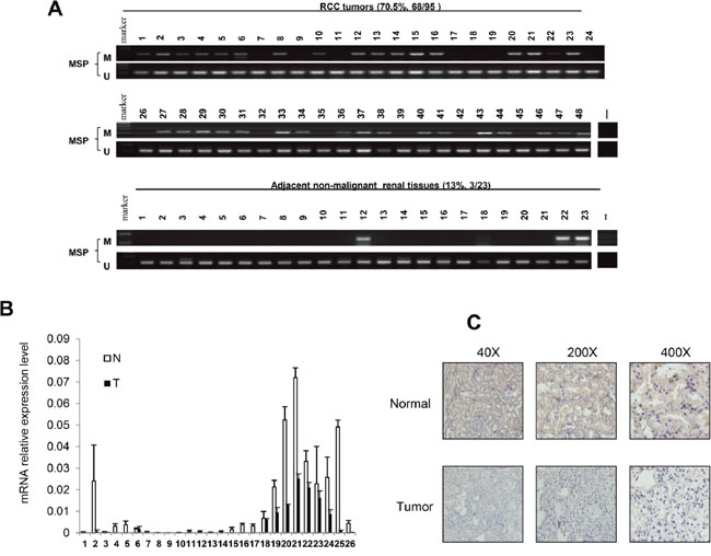 HOXA11 expression and promoter methylation in primary RCC tissues and adjacent non-malignant renal tissues.