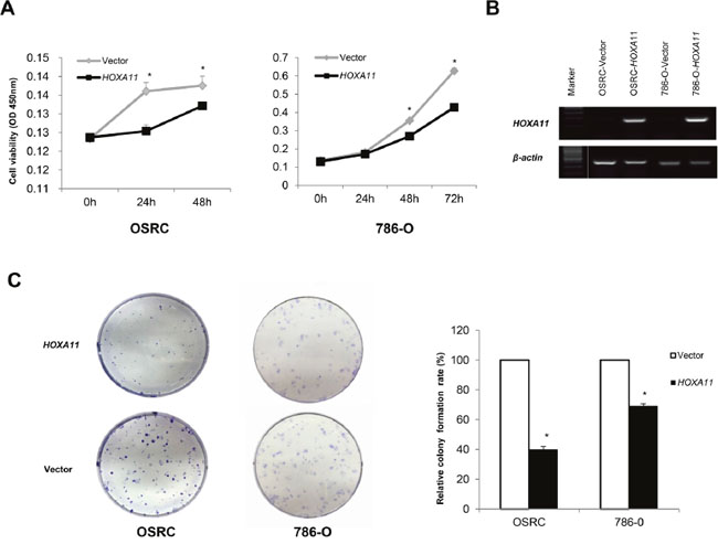 Ectopic expression of HOXA11 inhibits RCC cell proliferation and colony formation abilities.