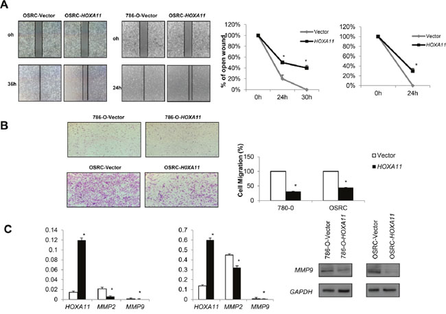 Effects of HOXA11 on RCC cell migration and invasion.