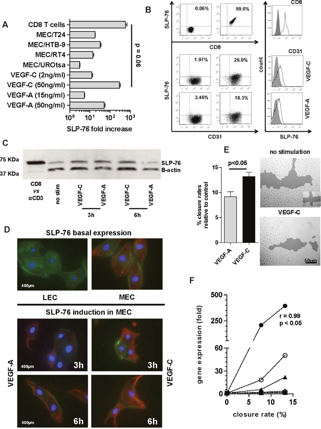 SLP-76 expression and production in MEC.