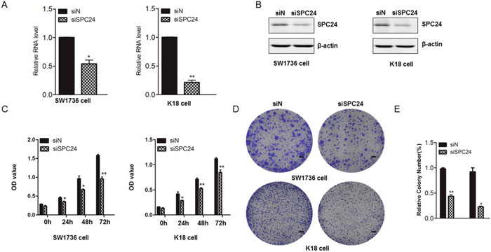 Silence of endogenous SPC24 by siRNA suppressed the proliferation of ATC.