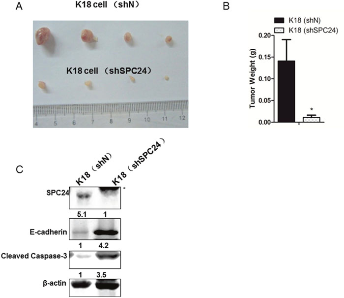 SPC24 promoted tumor initiation in xenograft mouse model and in human samples.