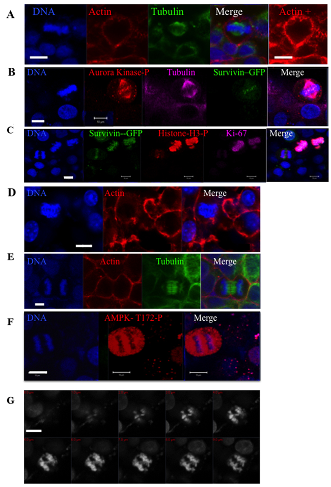 Immunofluorescence experiments on whole HeLa spheroids.