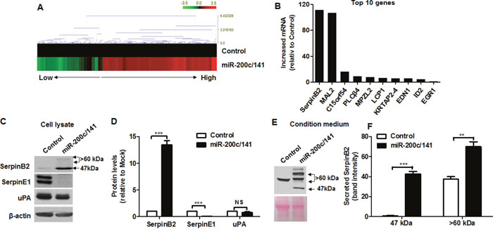 miR-200c/141 cluster overexpression upregulates SerpinB2.