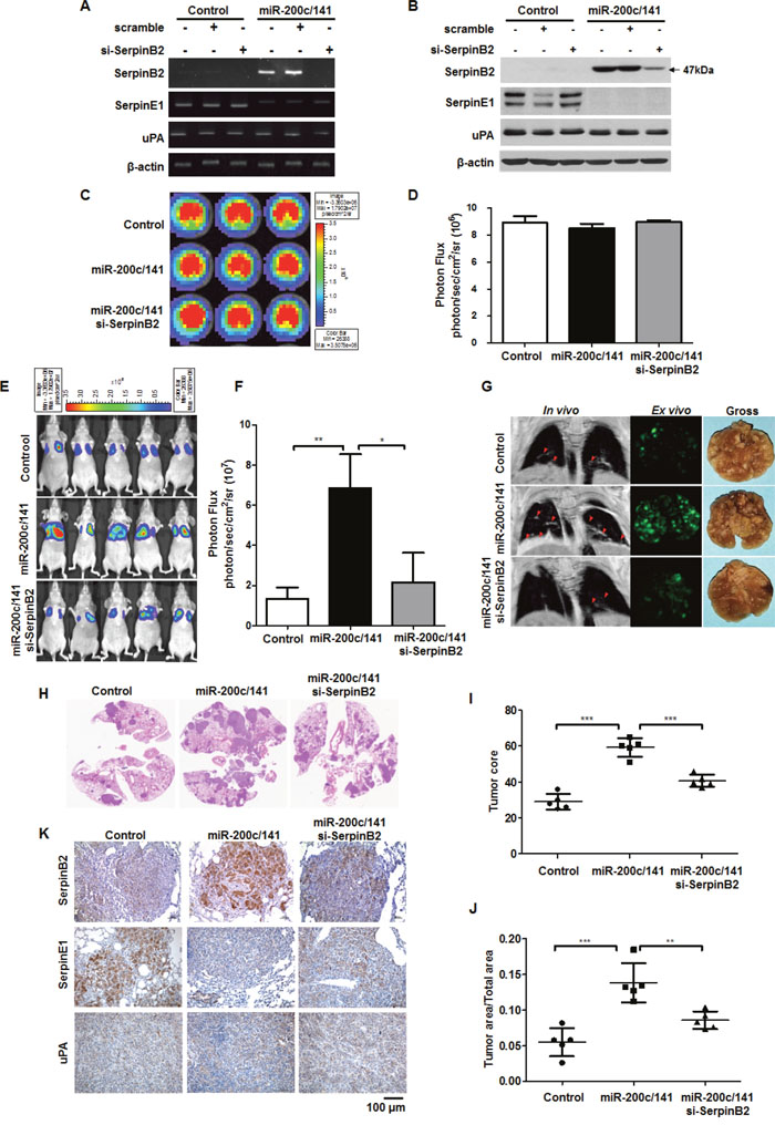 SerpinB2 knockdown decreased lung metastasis promoted by miR-200c/141 overexpression in BC cells.