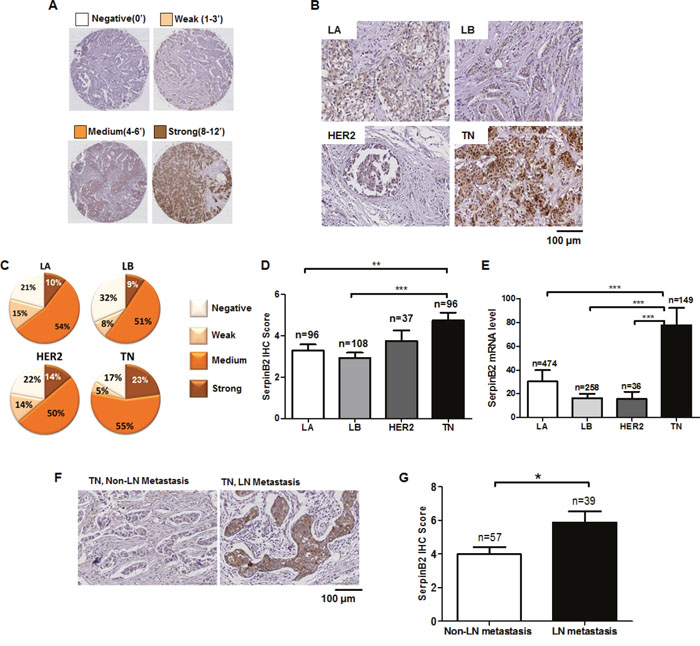 SerpinB2 is overexpressed in TNBC relative to other BC subtypes.