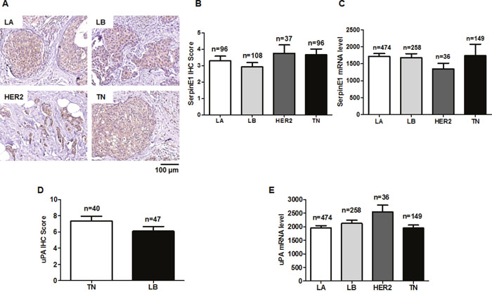 SerpinE1 and uPA levels do not differ among LA, LB, HER2, and TN subtypes.