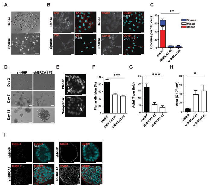 BRCA1 suppression reduces clonogenicity and alters phenotype and apicobasal polarity.