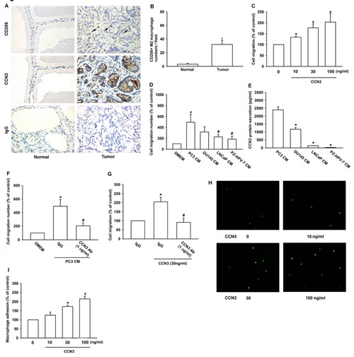 Fig 1: M2 Macrophage infiltration in human PCa specimens is related to CCN3 expression.