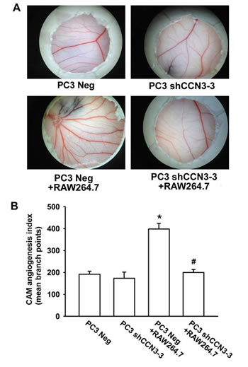 Fig 5: PCa-secreted CCN3 increases RAW264.7 macrophage-stimulated angiogenesis in vivo.