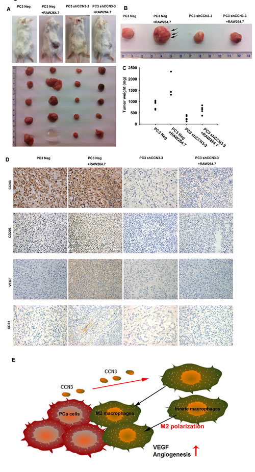 Fig 6: Knockdown of CCN3 in PCa cells inhibits RAW264.7-promoted angiogenesis and tumor growth in a mouse model.