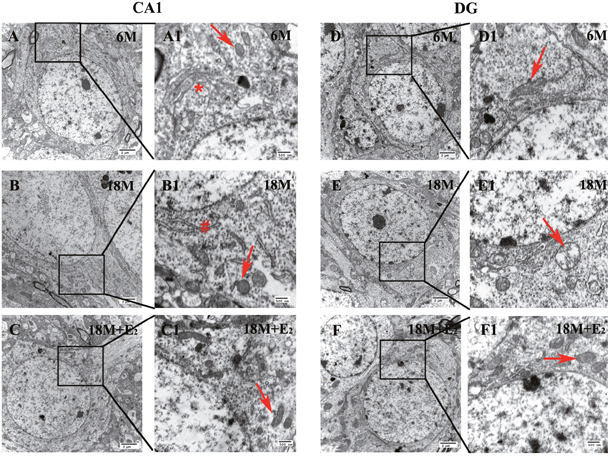 The morphology and ultrastructure of neurons in both CA1 and DG regions.