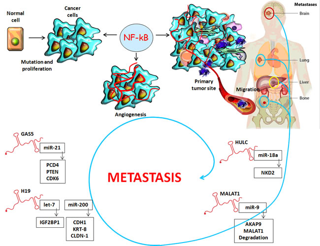 Long non-coding RNAs: A link between inflammatory microenvironment and cancer progression.