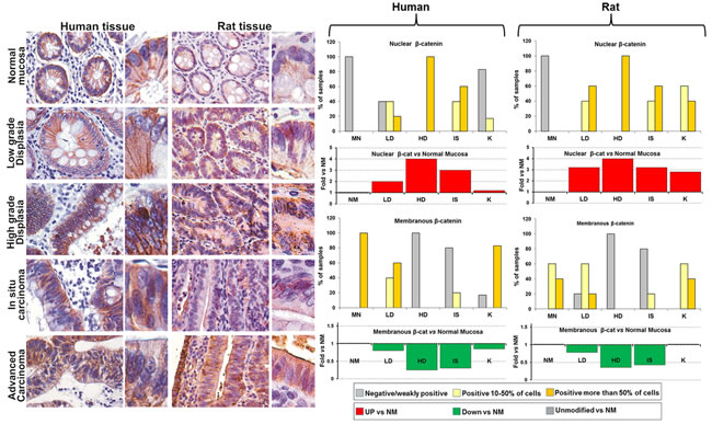 Comparative analysis of &#x3b2;-catenin expression and subcellular localization during the colorectal carcinogenesis in humans and rats.