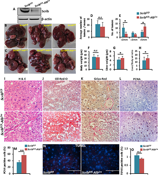 DEN-induced liver tumor growth is accelerated in Scrib-deficient mice.