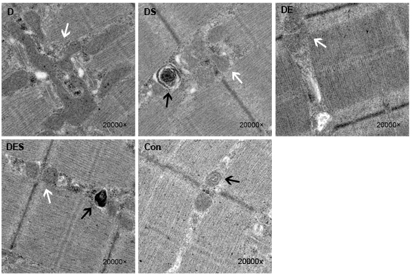 Transmission electron microscopic images showed damaged or swollen or fusion mitochondria, and disordered fiber arrangement or dysfunctional fiber structure in D-gal-induced aging gastrocnemius muscle (&times;20000).