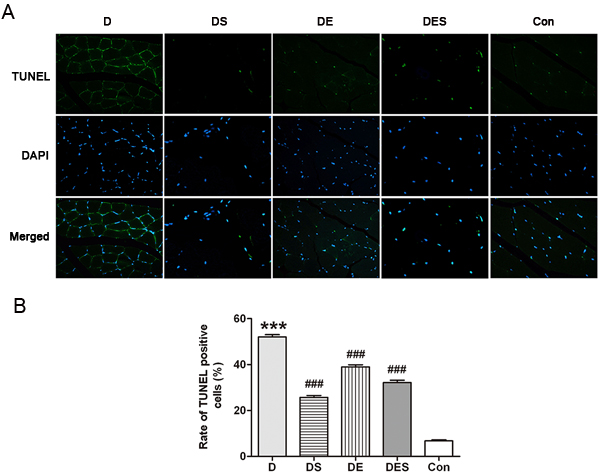 Apoptosis of skeletal muscle cells in different groups was evaluated by TUNEL assay, and the images were recorded by an Olympus fluorescence microscope, captured with a CCD monochrome camera Sensystem1401E at the magnification of &times;800.