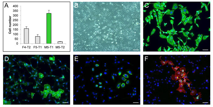 Characterization of the M5-T1 rat mesothelioma cell line
