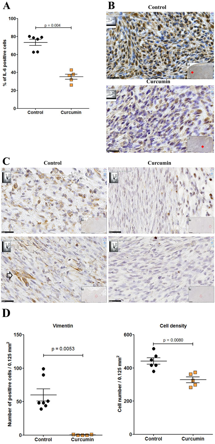 Residual tumor of rats treated with curcumin exhibited a significant decrease of IL-6 and vimentin expression.