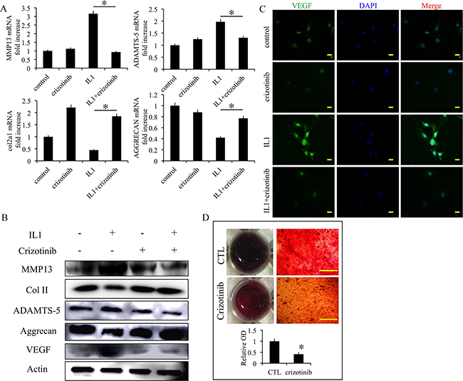 Effect of crizotinib in IL1-&#x03B2;-stimulated chondrocytes.