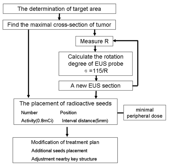 Diagram of the general TPS protocol of EUS-guided brachytherapy for unresectable pancreatic cancer.