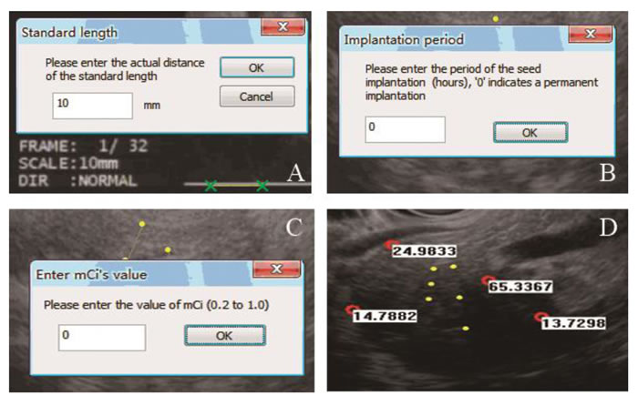 EUS TPS procedures were shown.