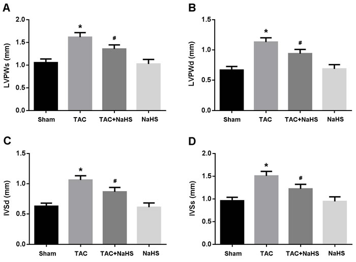 Echocardiographic evaluation of cardiac hypertrophy.