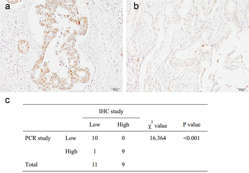 Kruppel-like factor 3 (KLF3) mRNA and protein expression, immunohistochemically evaluated in 20 colorectal cancer tissues.