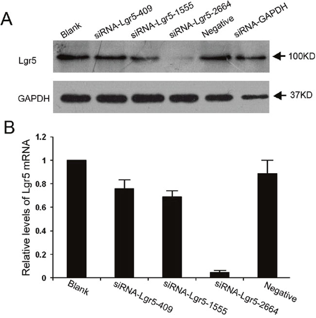 Suppression of Lgr5 protein and mRNA expression by siRNA in AGS gastric cells.