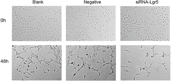 HUVEC were seeded on growth factor-reduced matrigel and stimulated for 48 h with regular cell culture medium (DMEM), conditioned medium from control siRNA-transfected cells, and medium preconditioned with Lgr5 siRNA-transfected cells.
