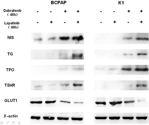 Western blot demonstrating the effects of different treatment on the protein levels of sodium iodine symporter (NIS), thyroglobulin (Tg), thyroid-stimulating hormone receptor (TSHR), thyroid peroxidase (TPO), glucose transporter-1 (GLUT1) in BCPAP (left) and K1 (right) cells.