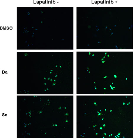 Immunofluorescent microscopic analysis of NIS protein expression in BCPAP cells.