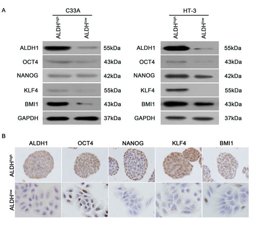 Expression of stem cell-associated markers in ALDH