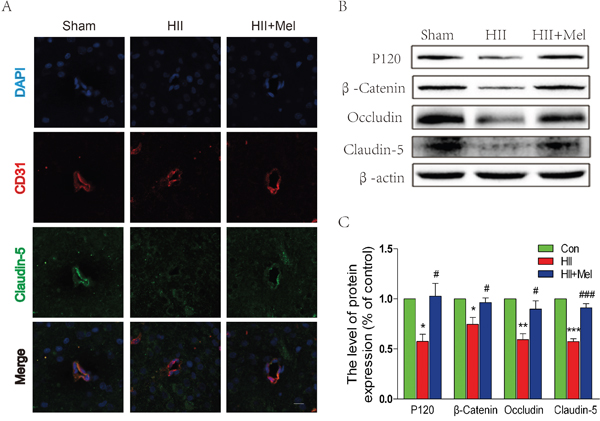 Melatonin prevented the loss of tight junction and adherens junction proteins after neonatal HII.