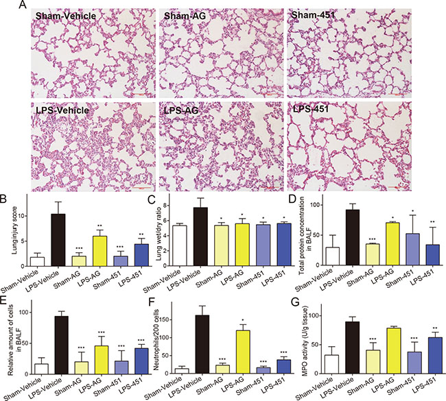 EGFR inhibitors attenuated the LPS-induced acute lung injury in rats.