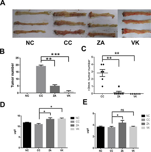 L. casei Zhang and Vitamin K2 prevent CRC development.