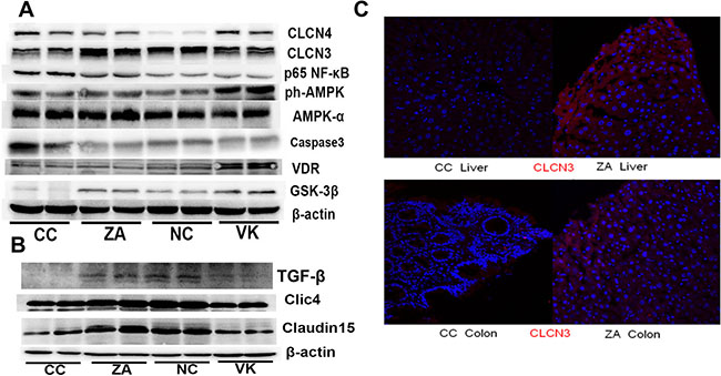 Liver and colonic expression of proteins involved in murine CRC.