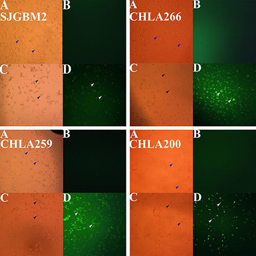 Pediatric brain tumor cells treated with carmofur underwent apoptosis as demonstrated by the Annexin-V-Alexa-488 conjugate staining.