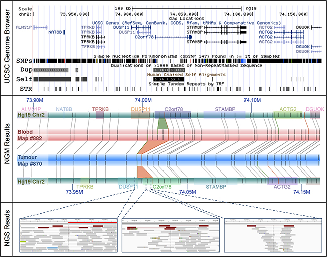 The DUSP11-C2orf78 gene fusion event identified using NGM involves a 14.3 Kb somatic deletion at Chr2: 74.006&#x2013;74.020 Mb.