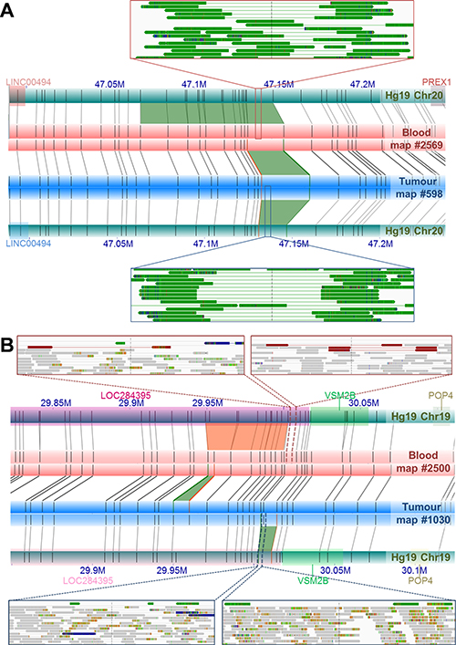 Examples of NGM-derived somatic SVs found in UP2153 with confounding calls by direct tumor-blood comparisons, compared to SV calls relative to Hg19.