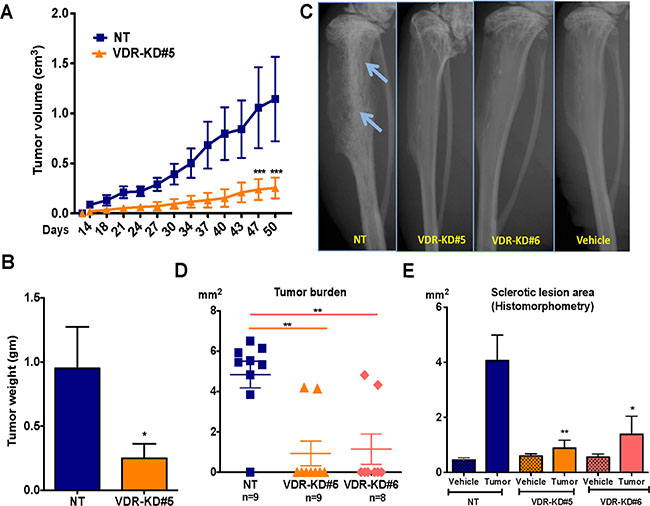 VDR knockdown in MCF-7 cells reduces orthotopic tumor growth and also reduces its capability to form tumor in the bone environments.
