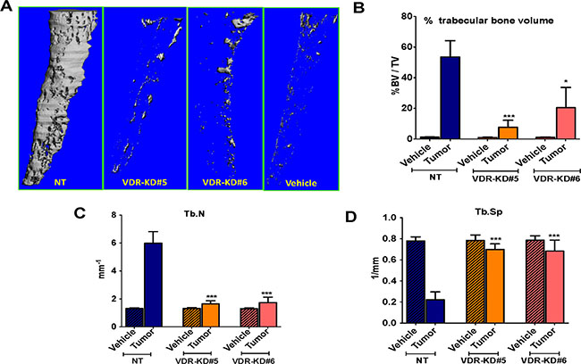 VDR knockdown in MCF-7 cells decreased osteosclerotic bone formation in bones of nude mice.