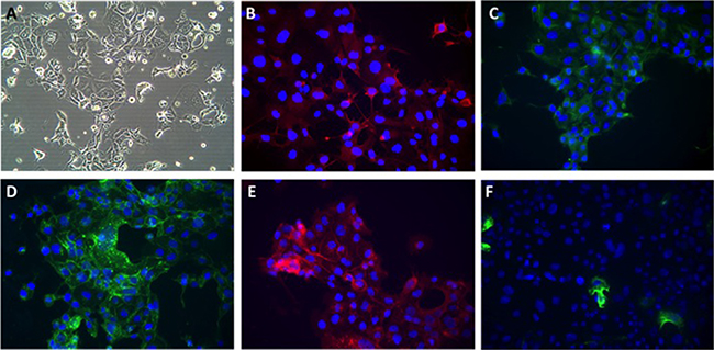 Phenotypic appearances of NUOC-1 cells.