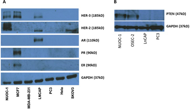 Receptor expression in NUOC-1 cell line assessed by western blotting.