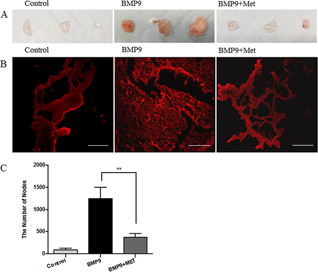 Metformin inhibits angiogenesis on mouse Matrigel plug.