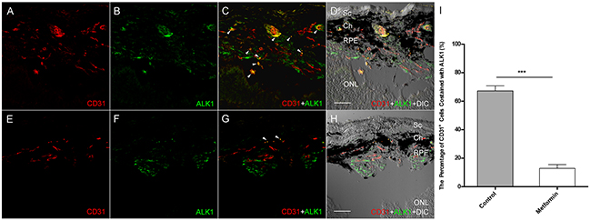 The effect of Metformin on ALK1 expression in Laser-induced CNV.