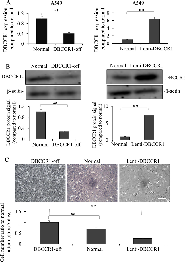 Knockdown and over-expressed of DBCCR1 effected the growth in A549 cell line.